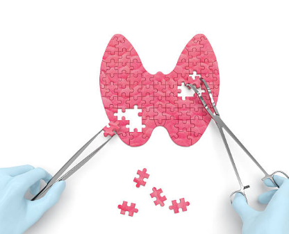 갑상선 기능 저하증 증상, 좋은음식, 수치 총정리 (2024ver)