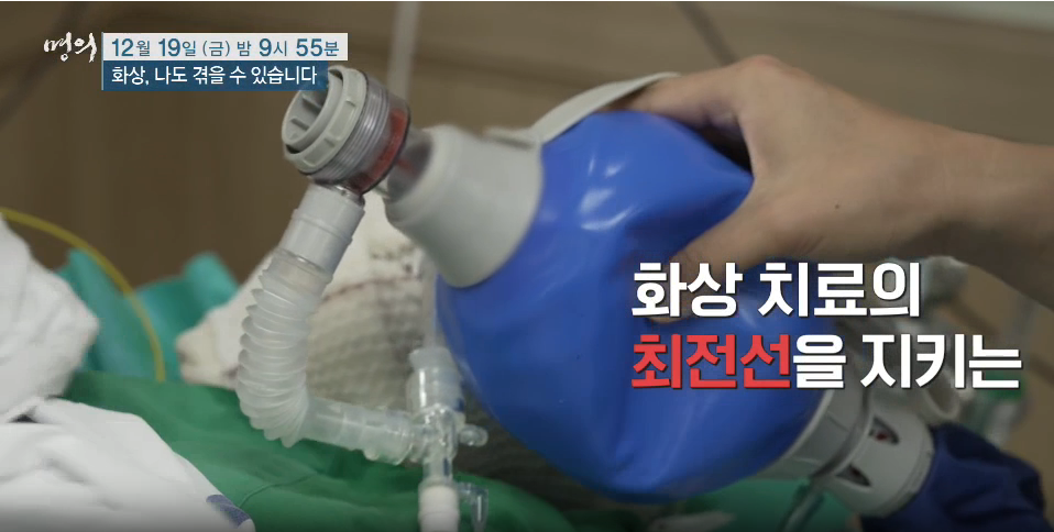 명의 화상 나도 겪을 수 있다