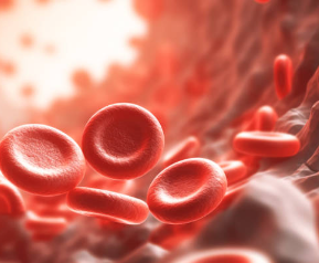 심부정맥혈전증