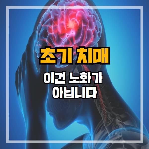 이건 노화가 아닙니다 &ndash; 초기 치매, 이렇게 시작됩니다