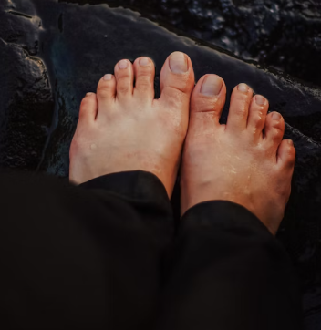 무좀 증상 치료법 원인 발톱 손톱