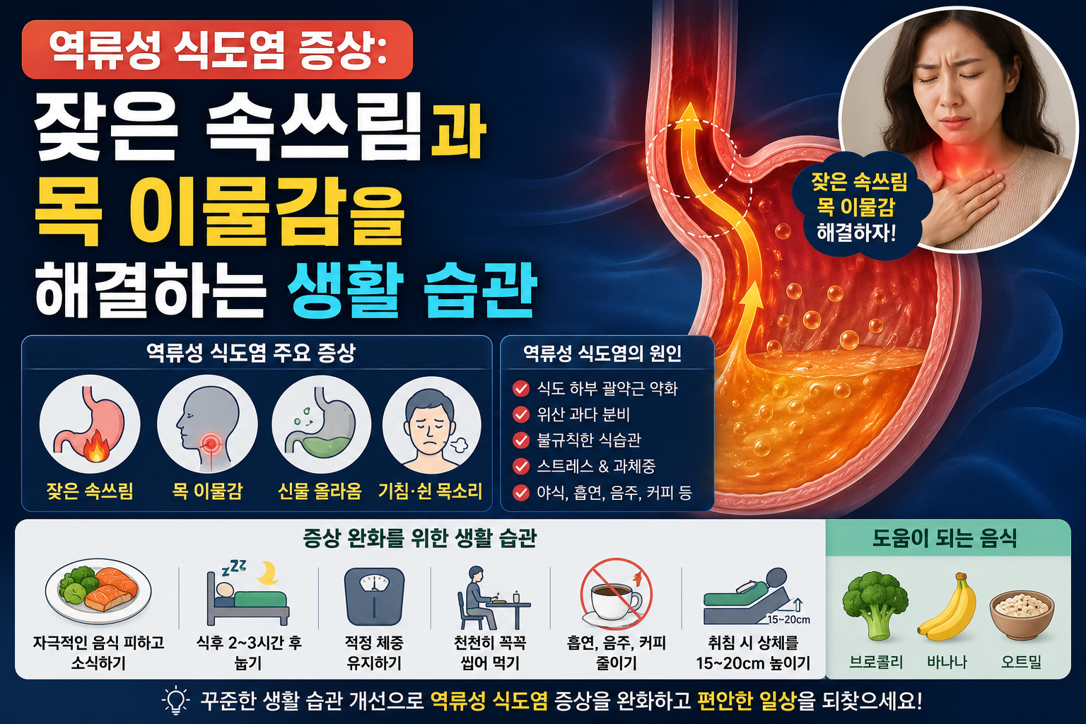 역류성 식도염 증상: 잦은 속쓰림과 목 이물감을 해결하는 생활 습관