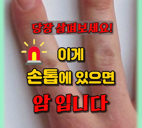 손톱에 세로줄이 생기는 이유