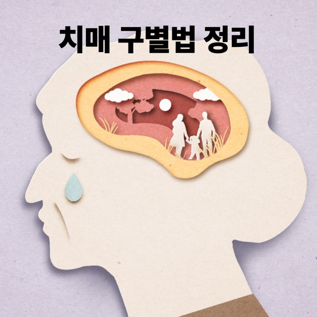 치매 구별법 정리