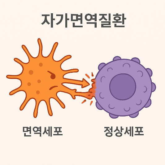 자가면역질환 종류와 원인