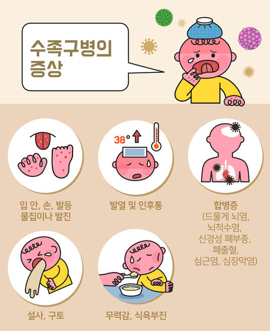 수족구병 잠복기,초기증상,감염경로,예방방법