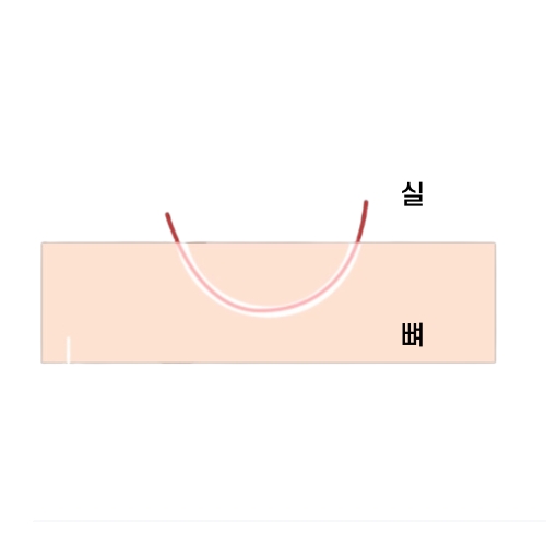 본터널링