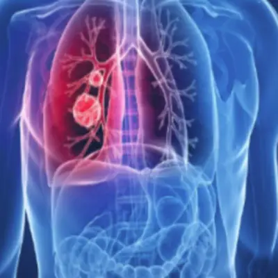 결핵-증상-원인-건강