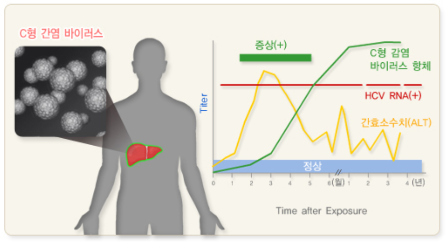 C형간염의 임상경과와 혈청학적 변화