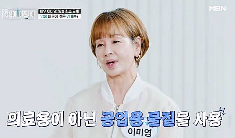 배우-이미영-입술