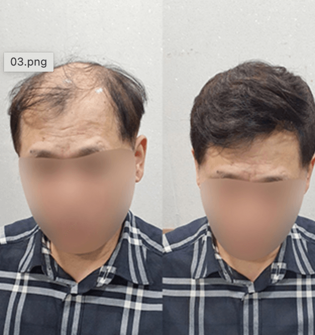 가발의여왕(메이모)