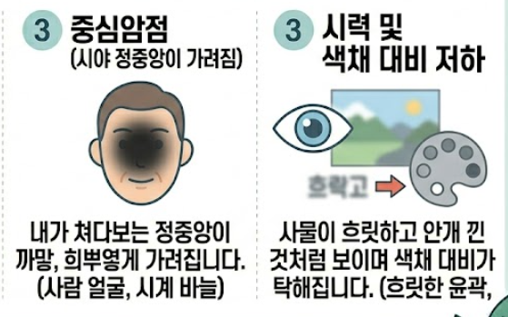 황반변성 증상