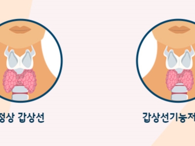 갑상선 이미지