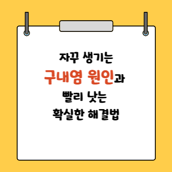구내염 원인과 빨리낫는방법