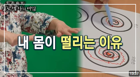 몸이 붓는 증상, 떨리는 증상, 간지러운 증상 원인과 치료