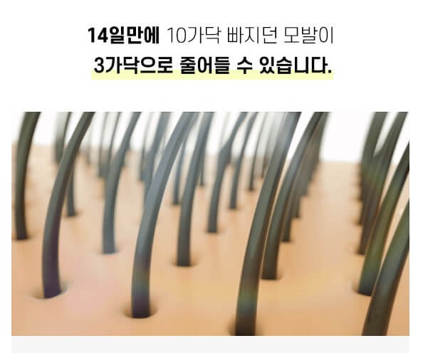 두피-속의-모발-사진입니다.