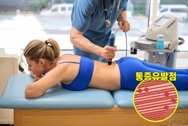 근육 뭉침 원인 허리통증 압통점