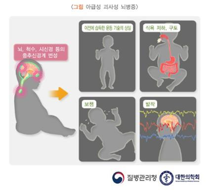 희귀질환 리이 증후군