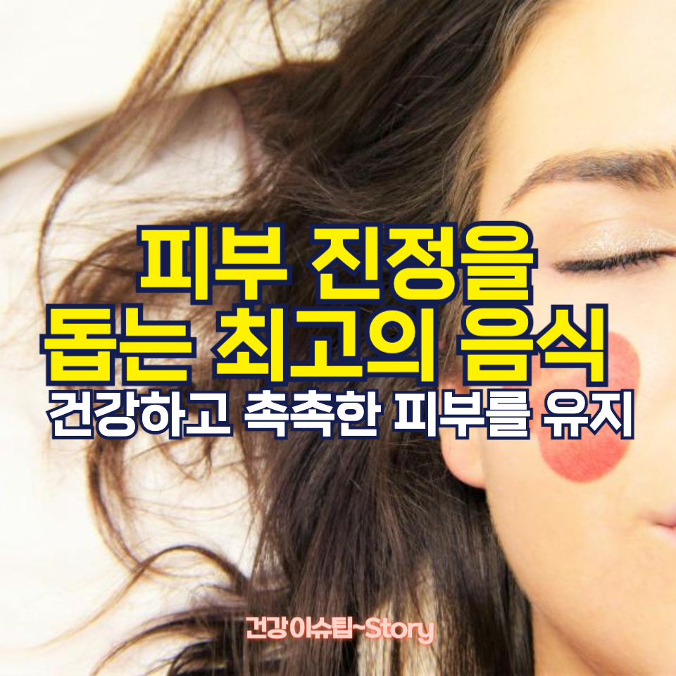 피부 진정에 좋은 음식 7가지!