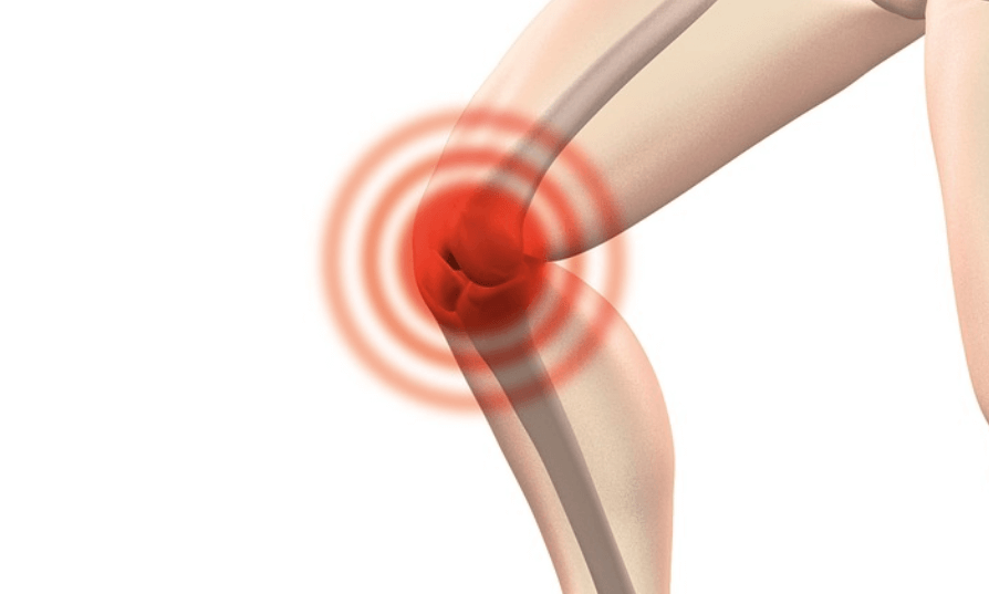 톳 효능은 뼈 건강에 도움이 된다 무릎 통증을 호소하고 있다