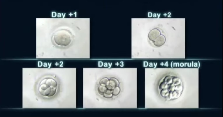 체외수정 기간
체외수정 방법
체외수정 부작용
체외수정 쌍둥이 확률
체외수정 성공확률