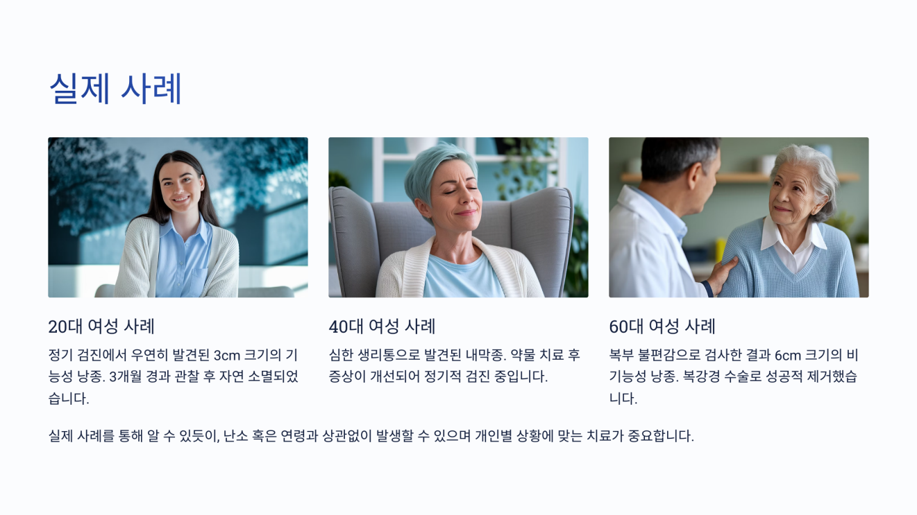 난소 혹 9