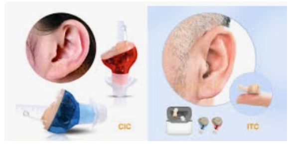 완전삽입형 & 귀속형