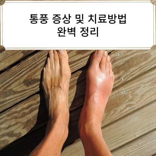 통풍 증상