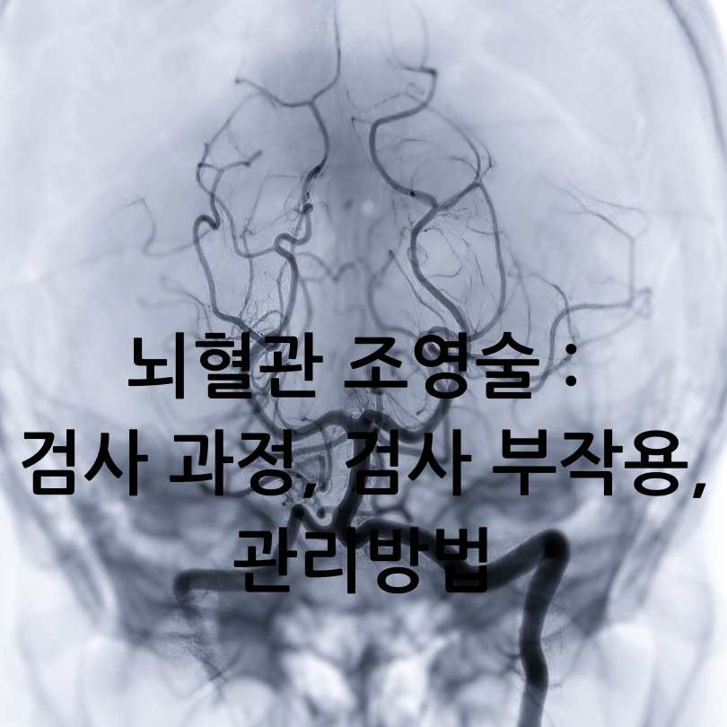 뇌혈관 조영술