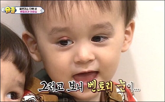 다래끼 치료 2