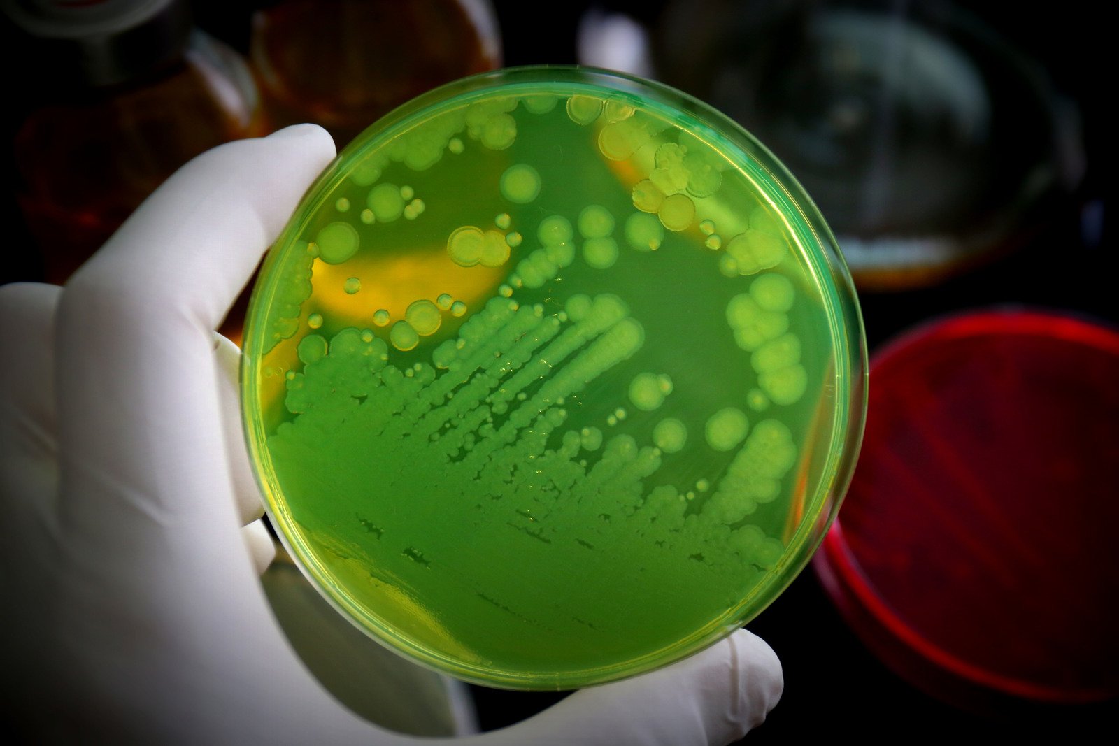 슈도모나스 감염