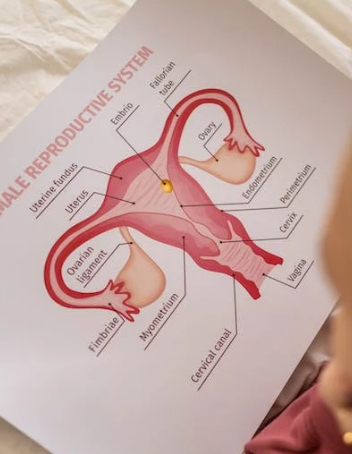 자궁내막증은 자궁 내막이 자궁 이외의 부위에 생겨나는 상태로, 이로 인해 생기는 심한 생리통이 주요 증상 중 하나이다