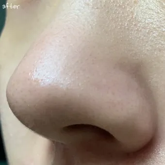 남자 얼굴 피지 제거 화장품 꿀템_25