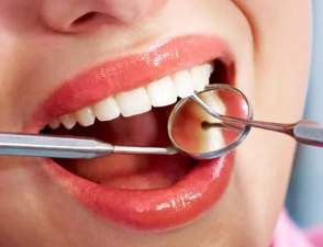 스케일링 가격? 의료보험 적용 비용 가이드