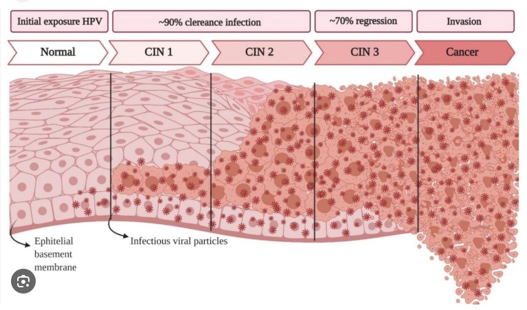 HPV 바이러스, 자궁경부암