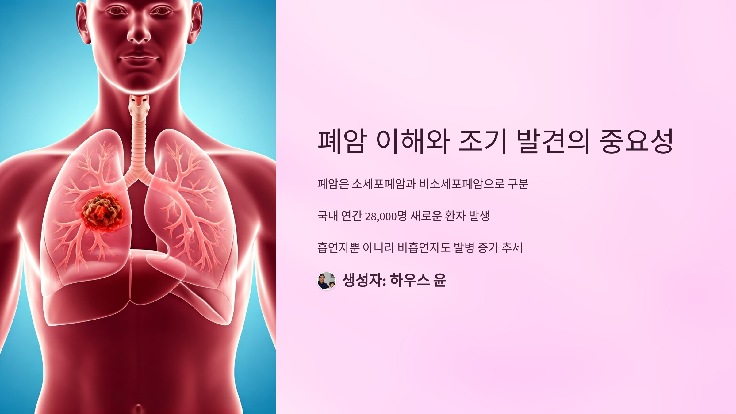 폐암 생존율 높이는 조기발견