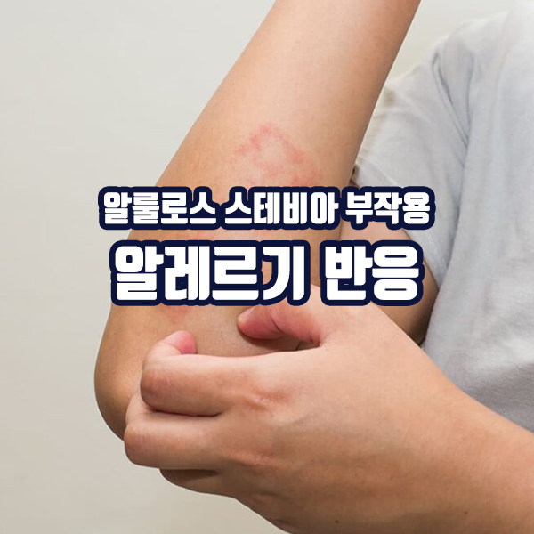 알룰로스 스테비아 부작용 - 알레르기 반응