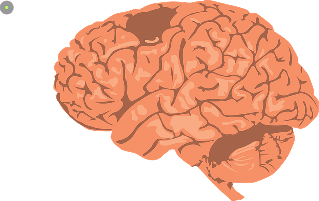 brain