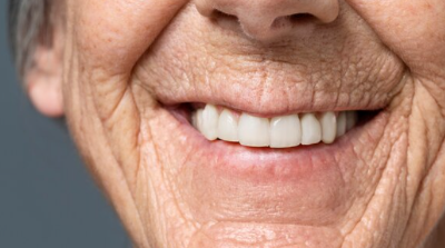 틀니 지원금 신청