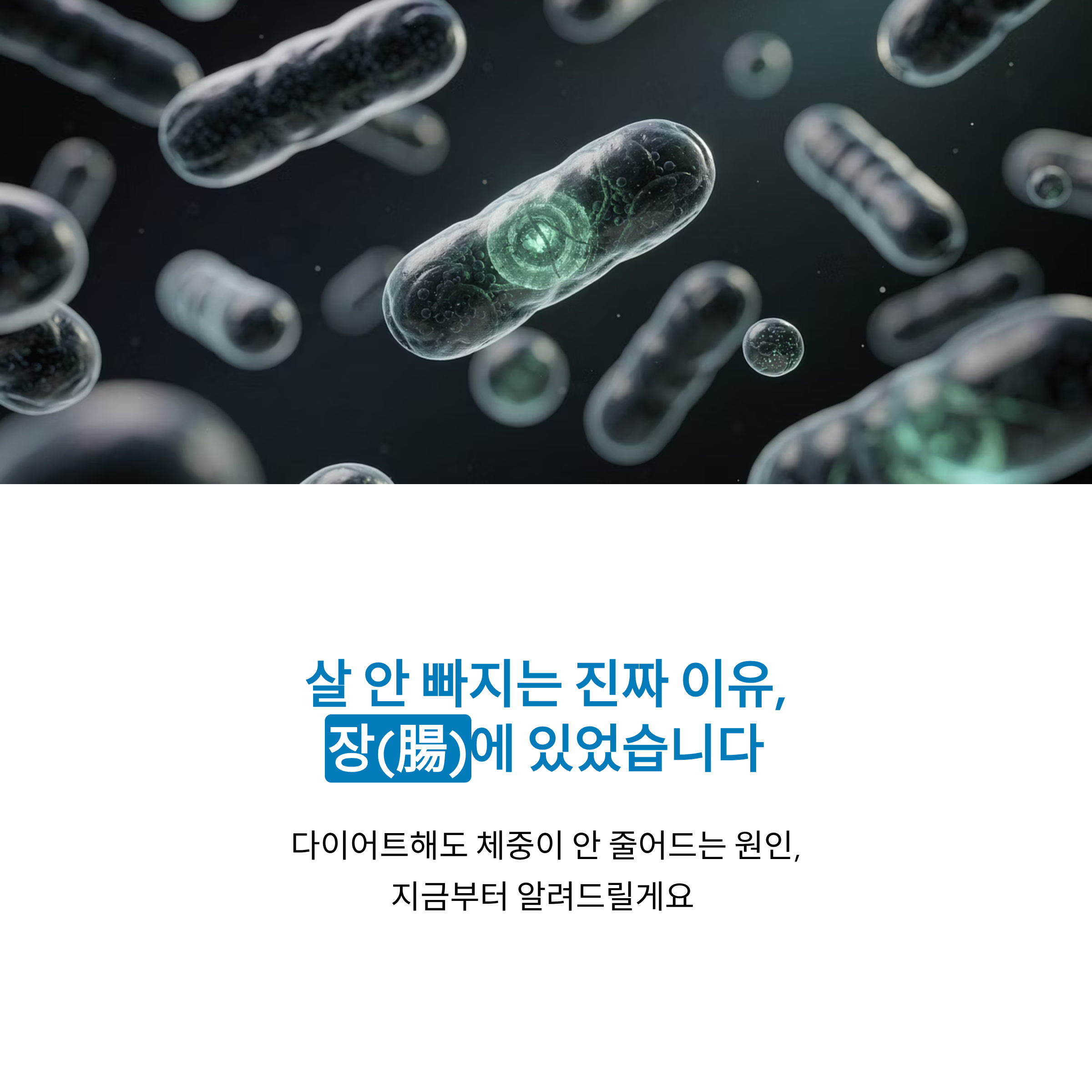 장 건강이 무너지면 살이 찐다