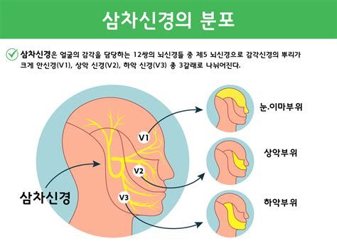 귀이명(이명) 치료법