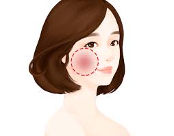 얼굴이 붉어지는 증상