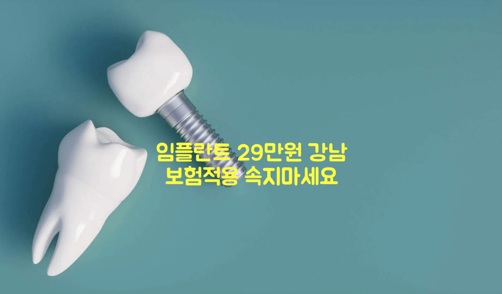 임플란트 속지마세요