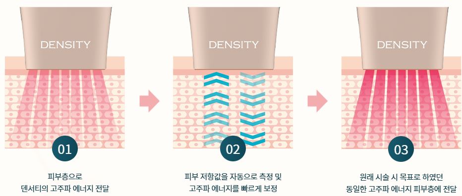 덴서티-효과
