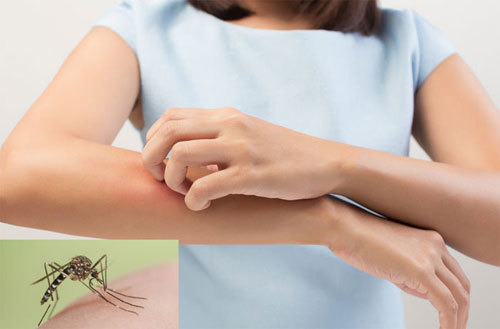 모기 잘 물리는 사람들의 특징 8가지