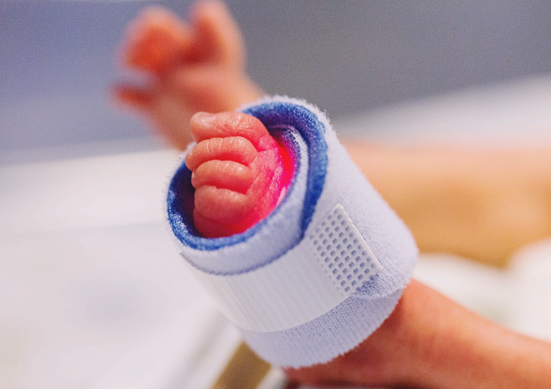 근섬유형 불균형, 원인이 불분명한 희귀한 선천성 신경근육 장애 질환