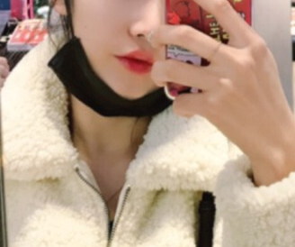 인중 축소 수술 후기