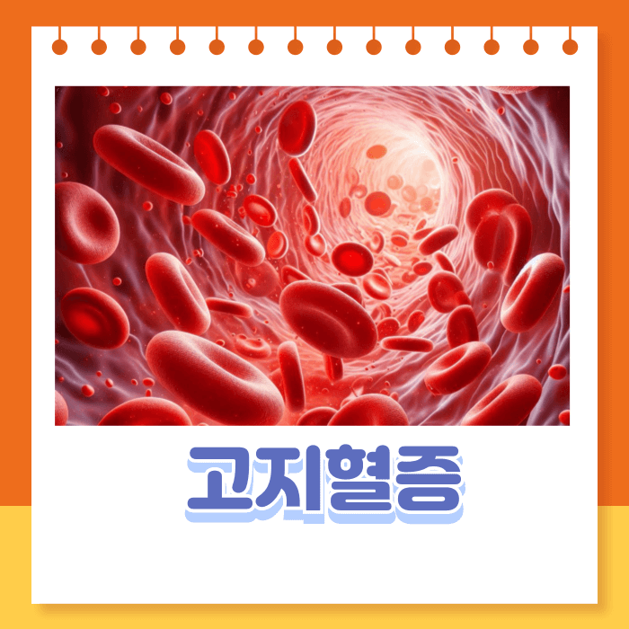 고지혈증원인 증상 고지혈증에 좋은음식