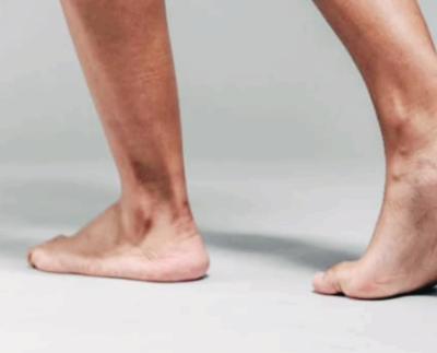 발이 붓는 이유와 증상&amp;#44; 발 부종 원인과 차이는?