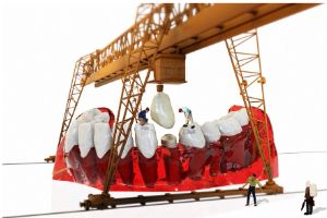 용인시-처인구-임플란트-치과-가격-비용-싼-곳&amp;#44;저렴한-곳&amp;#44;잘하는-곳&amp;#44;유명한-곳-BEST20-추천5